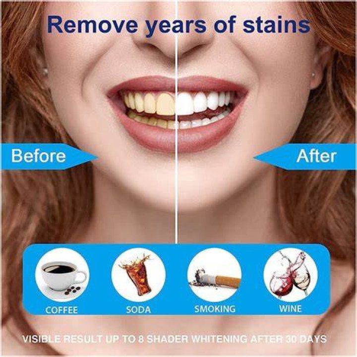 When do whitening strips start to work?